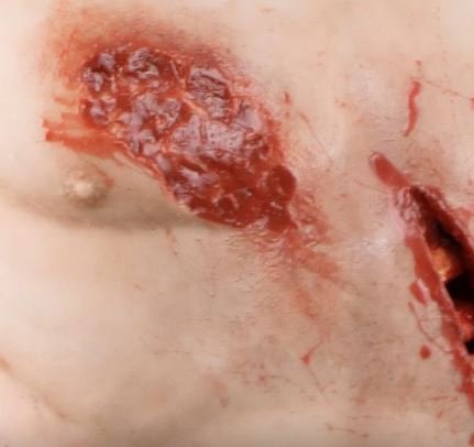 MEDICAL-X Trauma Trainer Torso - Image 7