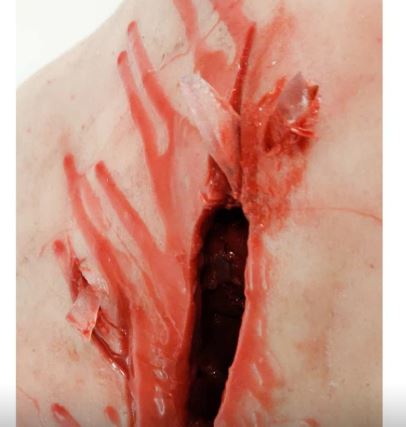 MEDICAL-X Trauma Trainer Torso - Image 6