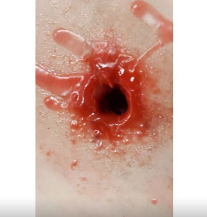 MEDICAL-X Trauma Trainer Torso - Image 4