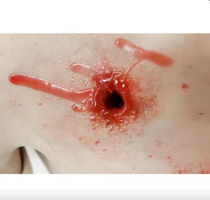 MEDICAL-X Trauma Trainer Torso - Image 3