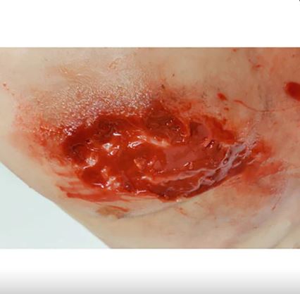 MEDICAL-X Trauma Trainer Torso - Image 2